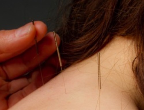 Acupuncture and Cancer Care